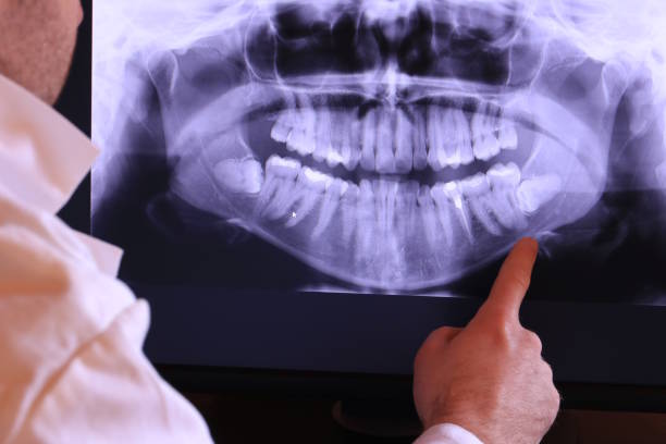 Best Emergency Dental Care for Sports Injuries in Sisseton, SD